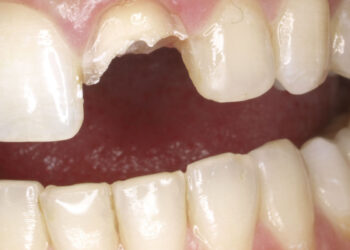 Los servicios jurídicos de IGC, logran que una entidad aseguradora abone a un socio todos los gastos ocurridos en un acto de servicio