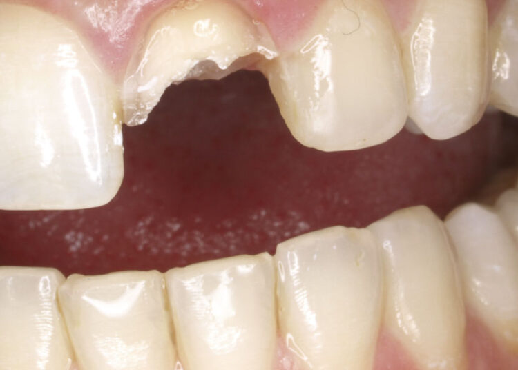 Los servicios jurídicos de IGC, logran que una entidad aseguradora abone a un socio todos los gastos ocurridos en un acto de servicio